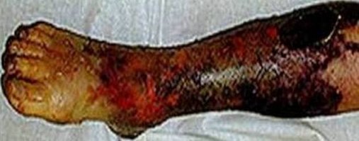 Фу мля! Это точно татуха а не гангрена конечности?