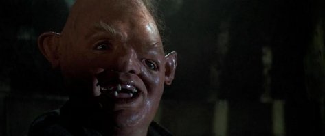 Братья стали изгоями из-за редкой аномалии, превратившей их зубы в акульи