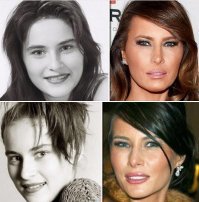 "Я против ботокса, я против инъекций... Я буду стареть достойно, как это делает моя мама ."
Ага!  Верим!
Верим, что нашла что-то получше ботекса... 
;-)