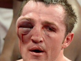 У кальмара неизвестного ранее вида один глаз оказался больше второго: маленький смотрит вверх и отслеживает опасность, а большой помогает в поисках пищи.
А может все куда проще?