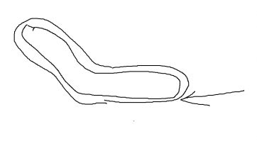 для тех кто не понял как затянуло.
затянуло под ручку, которая двигается. 
Как я понял, люди держали эту ручку чтобы она дальше не затянула руки. Хотя у эскалатора есть кнопка отключения экстренная, чо-то они затупили.