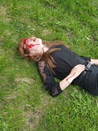 Перелом рук+чмт, но жить будет