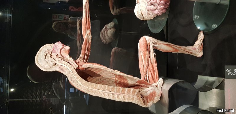 Были пару недель назад в Амстердаме. Там есть такой музей - Bodyworlds. Жуткое зрелище. Распиленные на части и забальзамированные, настоящие человеки. Прямо пластами нарезанные. Интересно конечно увидеть, как ты выглядишь изнутри, но всё равно жутко. бррр