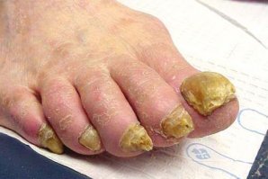 Любители носков под сандалии, эта новинка - для вас!