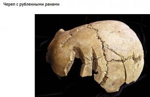 Крутой чувак. Такая толщина костей черепа, что пришлось два раза его рубить...