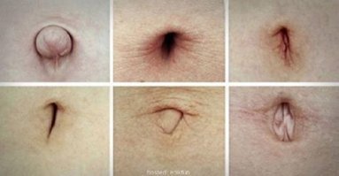 Серёга, у меня для тебя плохая новость - дурачок тут один. И это ТЫ!
Именно от врача, который перерезает пуповину, зависит, как будет выглядеть пупок, когда зарастёт.
Есть разные методы обрезания пуповины! Если в Гугле не забанен - поищи, почему пупы у людей отличаются. 
Причём есть люди, у которых нет пупков совсем. Их удаляют из-за пупочной грыжи.