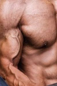 Да он это он, увеличь фото он весь в растяжках....