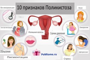 медицинские реальные причины ожирения . Самые распространенные. Поликистоз - 10% женщин, от 15 до 40% населения России страдают от тироидных патологий, при этом в отдельных регионах процент пациентов, приближается к 95%, синдром Кушинга как болезнь довольно редкая, но как сам синдром он 100% встречается у пациентов с аутоимунными заболеваниями , которые принимают гормональную терапию, а это по статистике минимум 30% людей в нашем Евроазиатском регионе. Так что, когда очередной раз будете гнобить очередного жирдяя-жидяйку, подумайте, что вы можете оказаться среди невезучих почти 40% и хотя бы сохранить свой вес , не говоря об ущербе для здоровья, для вас будет архисложно. Это пожизненно есть меньше и тренироваться больше, чем любой обычный, здоровый человек.  К стати, тренера вам в зале говорят, что кардио для похудения не должна длиться свыше 45 минут, потому что после происходит выброс кортизола, а хроническое повторение такого выброса приводит к кушингообразному виду, то есть скорее потолстеете, нежели похудеете.