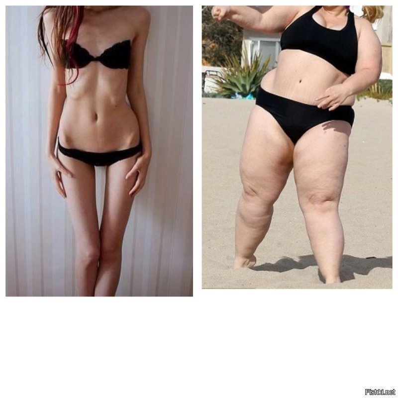 А если рассмотреть две предкрайности (на фото не самая худая и далеко не самая жирная девушка), на какую смотреть все-таки менее отвратительно?