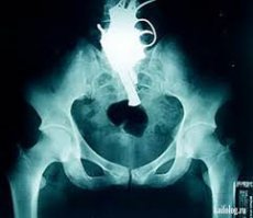 А вот еще одно место хранения))