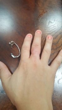 К черту кольцо, что с ногтями блд???!!!