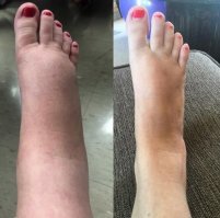 Да, беременность пошла на пользу - на левой фотографии ногти лучше накрашены.