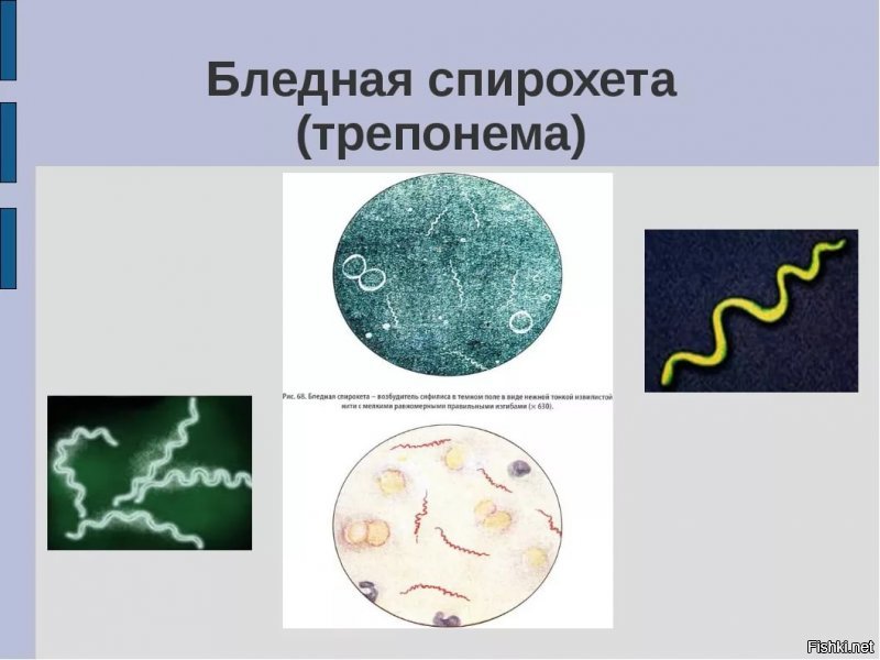 Распутные Наташи ЧМ-2018, или почему в России скоро будет много матерей-одиночек