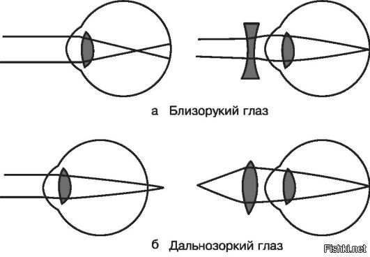 Близорукость на рисунке