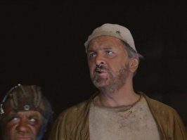 Девушка всю жизнь страдала от издевательств из-за особенности кожи