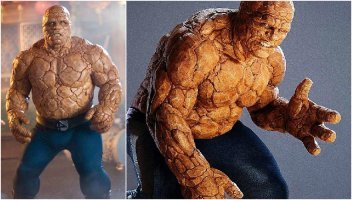 Пластический хирург "украсил" свою пациентку, введя ей под кожу цемент