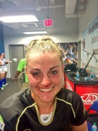 ей реально сломали нос, и да она красава...