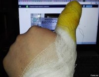 Мне тоже однажды повезло.

Мачете соскользнул и попал прямо по пальцу. Если бы не кривой сучок перед пальцем, направивший лезвие чуть дальше (прямую ветку снёс бы и не останавливаясь отрубил бы палец), если бы не зазубрина в том месте лезвия, которым попало по пальцу, если бы попало не по ногтю, то снёс бы я себе себе часть пальца. А так только ноготь срезал.