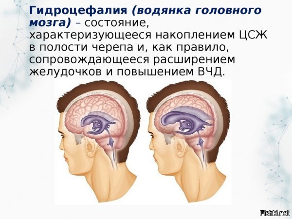 Тут два варианта, Либо

Но возможно он просто рептилоид