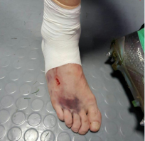 Илья Кутепов часть матча играл вчера с травмой голеностопа - эту фотографию он прислал отцу из раздевалки сразу после игры.

И все-таки они не деревянные! Спасибо, Команда! Спасибо, Тренер!!!