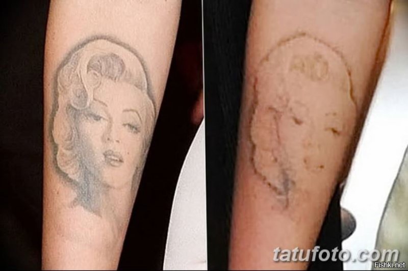 А, что, у Меган Фокс на правой руке остатки неудачного сведения тату портрета Мерлин Монро???...