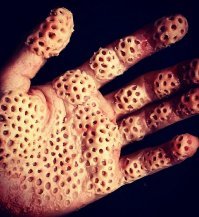 Не страдаю, но ощущения странные.