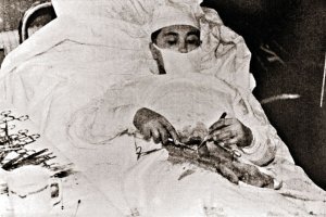 О, да... 150 селфи, 1560 слов, свадьба, тиражи, болельщики... 

Леони д Ива нович Ро гозов (1934 2000)   врач-хирург, участник 6-й Советской антарктической экспедиции, в 1961 году сделавший сам себе операцию по поводу острого аппендицита.

В 1959 году Леонид Рогозов окончил институт и сразу же был зачислен в клиническую ординатуру по хирургии. Однако обучение в ординатуре было на время прервано в связи с тем, что 5 ноября 1960 года Леонид отбыл на дизель-электроходе  Обь  в Антарктиду в качестве врача 6-й Советской Антарктической экспедиции. В Антарктиде, куда судно прибыло в декабре, Леонид Рогозов, помимо своей основной должности, исполнял обязанности метеоролога и даже водителя. После девяти недель подготовительных работ, 18 февраля 1961 года, в оазисе Ширмахера была открыта новая советская антарктическая станция   Новолазаревская. Во время первой зимовки на ней произошло событие, сделавшее 27-летнего хирурга известным на весь мир.
29 апреля 1961 года Леонид обнаружил у себя тревожные симптомы: слабость, тошноту, повышенную температуру тела и боли в правой подвздошной области. Будучи единственным врачом в экспедиции, состоявшей из 13 человек, Леонид сам поставил себе диагноз: острый аппендицит. Консервативная тактика лечения (покой, голод, местный холод и антибиотики) успеха не имела. На следующий день температура поднялась ещё выше. Ни на одной из ближайших антарктических станций не было самолёта, кроме того, плохие погодные условия всё равно не позволили бы выполнить полёт на Новолазаревскую, находящуюся в 80 км от берега. Для того, чтобы спасти жизнь заболевшего полярника, необходима была срочная операция на месте. И единственным выходом в сложившейся ситуации было делать операцию самому себе.

Выполнять операцию ночью 30 апреля 1961 года хирургу помогали метеоролог Александр Артемьев, подававший инструменты, и инженер-механик Зиновий Теплинский, державший у живота небольшое круглое зеркало и направлявший свет от настольной лампы. Начальник станции Владислав Гербович дежурил на случай, если кому-то из ассистентов, никогда не имевших отношения к медицине, станет плохо. В лежачем положении, с полунаклоном на левый бок, врач произвёл местную анестезию раствором новокаина, после чего сделал при помощи скальпеля 12-сантиметровый разрез в правой подвздошной области. Временами смотря в зеркало, временами на ощупь (без перчаток), он удалил воспалённый аппендикс и ввёл антибиотик в брюшную полость. Спустя 30 40 минут от начала операции развилась выраженная общая слабость, появилось головокружение, из-за чего приходилось делать короткие паузы для отдыха. Тем не менее, к полуночи операция, длившаяся 1 час 45 минут, была завершена. Через пять дней температура нормализовалась, ещё через два дня были сняты швы.