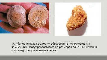Найди отличия.