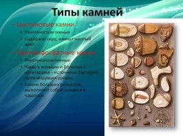 Найди отличия.