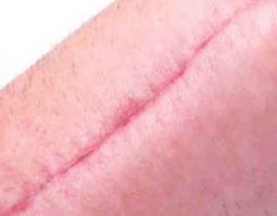 Интересно, сколько у этих девушек шрамов на теле?