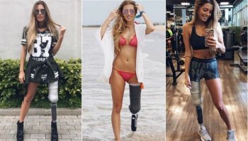 Потеряла левую ногу, а на фотке справа - протез правой ноги