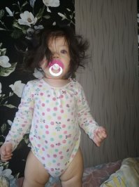 С чего вдруг - отклонения?!! Просто генетика такая... Я, сам родился с такими длинными, темными волосами...В мае прошлого года у меня родилась дочка - тоже с длинными, темными волосами(на фото ей- 11 мес.):)