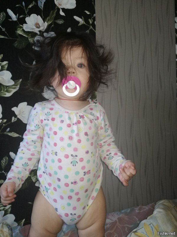 С чего вдруг - отклонения?!! Просто генетика такая... Я, сам родился с такими длинными, темными волосами...В мае прошлого года у меня родилась дочка - тоже с длинными, темными волосами(на фото ей- 11 мес.):)