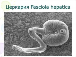 Ну дождевые червяки под кожу, как всем известно, не залазят.

Церкариоз (от греч.: Κέρκος   хвост) или зуд купальщика   это заболевание человека, проявляющееся в виде сыпи, вызванной проникновением под кожу личинок (церкарий) некоторых видов шистосом, которые при нормальном цикле развития заражают птиц и некоторых других животных.
Другие синонимы: синдром пловца, шистосомный дерматит.
Церкарии предварительно выходят в пресную или соленую воду из тела зараженных улиток. Природным окончательным хозяином этих является конкретная птица или млекопитающее. При контакте с плавающим в водоеме человеком паразит способен проникнуть в кожу, вызывая аллергические реакции и сыпь, но дальше личинки развиваться не (погибнут). Случаи заболевания церкариозом встречается по всему миру, и фиксируются чаще всего в течение летних месяцев.
Шистосомный церкариоз не является инфекционным заболеванием и не может передаваться от одного человека к другому. К тому же зуд купальщика не несет серьезной опасности для людей и, как правило, имеет хороший прогноз. Симптомы обычно проходят в течение нескольких дней, так как личинки шистосом не могут выживать в человеческом организме более длительный период.