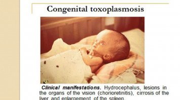 Прекрасно, в условиях отсутствия эффективной вакцины от токсоплазоза, как автор собирается гарантировать что все кошки здоровы, а? 
Конечно, обычно хватает простого соблюдения гигиены и чтоб лоток убирал кто-нибудь другой, но автор похоже этим ограничиваться не хочет.

Давай тогда заодно и фотографии от тех кому "не повезло" в лотерею с здоровыми кошками. Где милые фоточки гидроцефалов, отёков лимовых узлов, желтушности от цирроза печени?