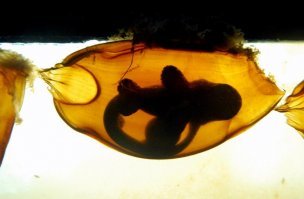 Это яйцо акулы)