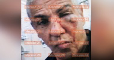 узнай звезду по бланшу ))))