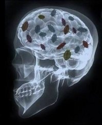 Ещё нужно было бы требовать рентген мозга.