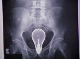 Участниц конкурса красоты обязали предъявлять рентген зада