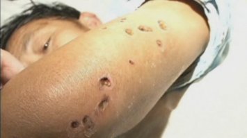 Ну да. Как комарик укусил.