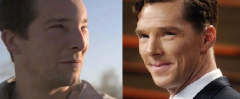 У одного отёк сойдёт, а другому всю жизнь таким фейсом довольствоваться...