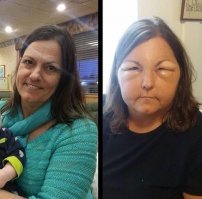 Ну тут, как бы, и до аллергии не красотки!!(