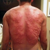 Похоже он забыл как выглядит борщевик ...