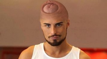 Это шокирует: Ким Карадашьян «вживила» под кожу необычное ожерелье