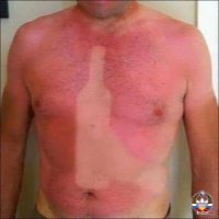 Переборщила с солнечными ваннами)