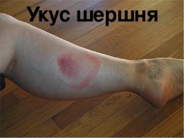 Шершни построили огромное гнездо в салоне автомобиля