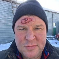 у него и на мерсе не сработала?