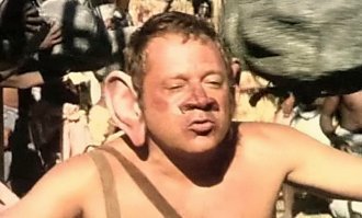 Барышня разревелась, увидев свои губы после пластической операции