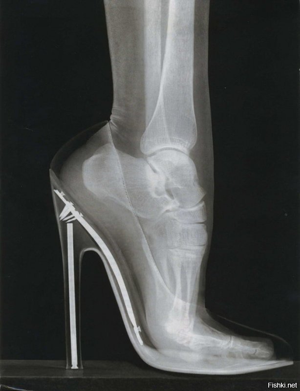 Поперечное сечение стопы слона