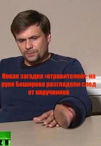 Из СМИ : 
Пользователи сети рассмотрели  след от наручников на руке Боширова.